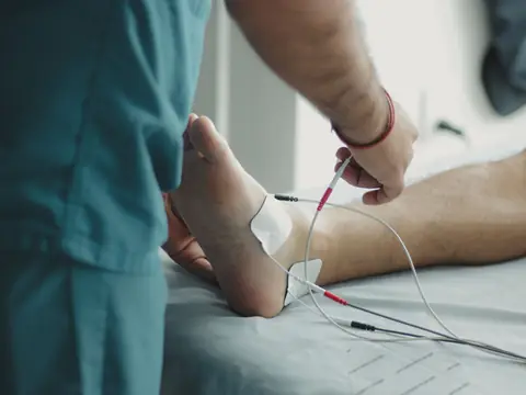 Clinician attaching fine clip leads to electrode pads on a patient's foot and ankle